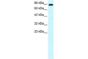 KIF21A antibody used at 0. (KIF21A 抗体  (N-Term))