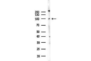 anti-phosphodiesterase 4D, cAMP-Specific (PDE4D) (C-Term) antibody