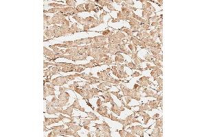 Immunohistochemistry (Paraffin-embedded Sections) (IHC (p)) image for anti-Collagen, Type V, alpha 1 (COL5A1) (AA 54-82), (N-Term) antibody (ABIN654444)