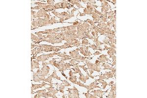 Immunohistochemical analysis of paraffin-embedded Human heart tissue using A performed on the Leica® BOND RXm. (COL5A1 抗体  (N-Term))