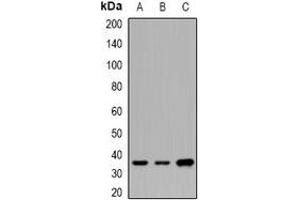 Western blot analysis of CNTFR alpha expression in SW620 (A), BT474 (B), mouse brain (C) whole cell lysates. (CNTF Receptor alpha 抗体)