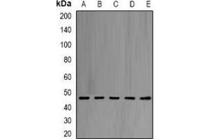Western blot analysis of eIF4A1 expression in Hela (A), Jurkat (B), NIH3T3 (C), PC12 (D), mouse liver (E) whole cell lysates. (EIF4A1 抗体)
