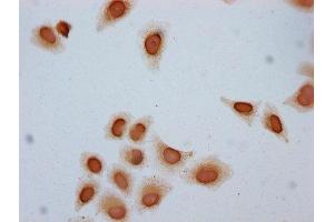 Immunocytochemistry analysis of ABIN7139174 diluted at 1:10 and staining in Hela cells (treated with 30mM sodium butyrate for 4h) performed on a Leica BondTM system. (Histone H2B 抗体  (acLys24))