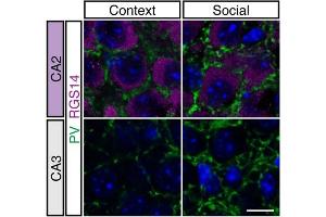 Representative images and quantification of PV+ puncta density in mice CA2/CA3 stratum pyramidale. (RGS14 抗体  (AA 1-544))