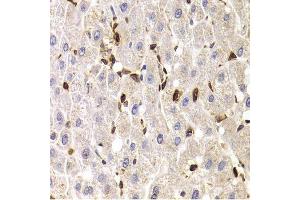 Immunohistochemistry of paraffin-embedded human liver injury using SPN antibody. (CD43 抗体  (AA 276-400))