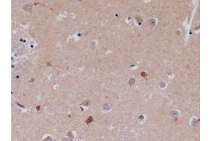 Immunohistochemistry (IHC) image for anti-Mast/stem Cell Growth Factor Receptor (KIT) (AA 321-520) antibody (ABIN7431107)