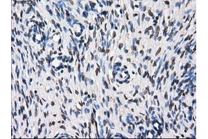 Immunohistochemical staining of paraffin-embedded Kidney tissue using anti-TTLL12mouse monoclonal antibody. (TTLL12 抗体)