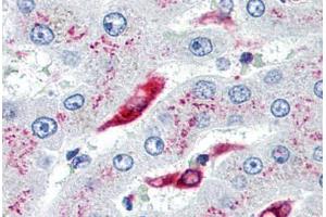 Human Liver, Kupffer Cells (formalin-fixed, paraffin-embedded) stained with CD74 antibody ABIN239807 at 10 µg/ml followed by biotinylated anti-mouse IgG secondary antibody ABIN481714, alkaline phosphatase-streptavidin and chromogen. (CD74 抗体)