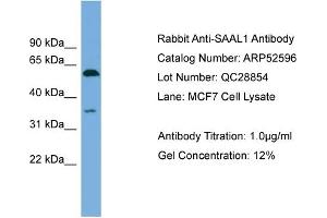 WB Suggested Anti-SAAL1  Antibody Titration: 0. (SAAL1 抗体  (N-Term))
