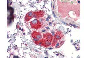 Immunohistochemistry (IHC) image for anti-Zinc Finger Protein 36, C3H Type, Homolog (Mouse) (ZFP36) (Middle Region) antibody (ABIN2780505)