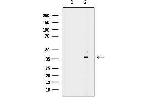 anti-Carcinoembryonic Antigen-Related Cell Adhesion Molecule 6 (CEACAM6) (Internal Region) antibody