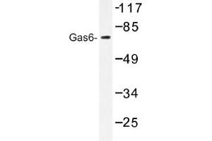 Image no. 1 for anti-Growth Arrest-Specific 6 (GAS6) antibody (ABIN317613) (GAS6 抗体)