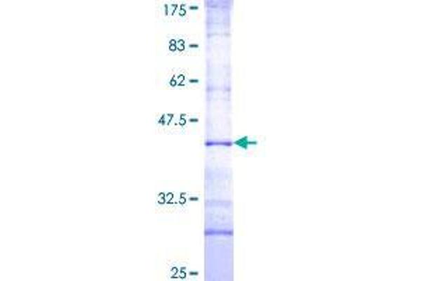 TRIM69 Protein (AA 33-121) (GST tag)