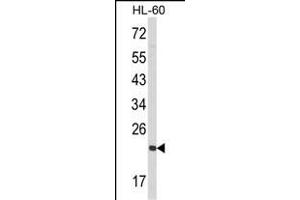 Western blot analysis of RAN Antibody (N-term) (ABIN390647 and ABIN2840945) in HL-60 cell line lysates (35 μg/lane). (RAN 抗体  (N-Term))