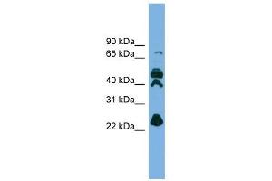 RPE antibody used at 1 ug/ml to detect target protein. (RPE 抗体  (N-Term))