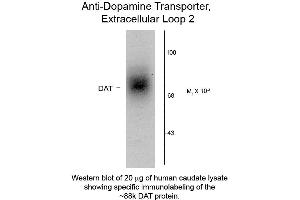 Western Blot of Anti-Dopamine Transporter (Rabbit) Antibody - 600-401-D30 Western Blot of Rabbit Anti-Dopamine Transporter C-Terminus Human Antibody. (SLC6A3 抗体  (Extracellular Loop))