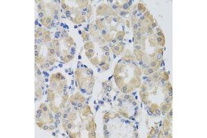 Immunohistochemistry of paraffin-embedded human stomach using GPT antibody. (ALT 抗体  (AA 1-190))