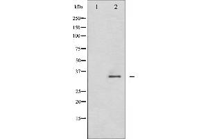 Western blot analysis of CDK2 phosphorylation expression in A2780 whole cell lysates,The lane on the left is treated with the antigen-specific peptide. (CDK2 抗体  (pThr160))