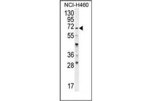 Western blot analysis of FUT4 Antibody (C-term) in NCI-H460 cell line lysates (35ug/lane). (CD15 抗体  (C-Term))
