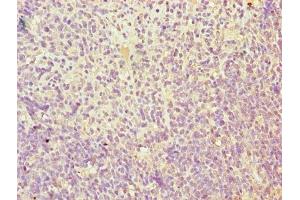 Immunohistochemistry of paraffin-embedded human thymus tissue using ABIN7173111 at dilution of 1:100 (TMEM184C 抗体  (AA 107-178))