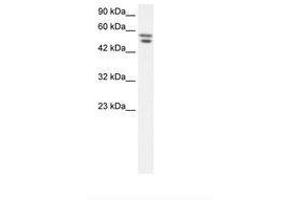 Image no. 1 for anti-Zinc Finger Protein 768 (ZNF768) (AA 57-106) antibody (ABIN202709) (ZNF768 抗体  (AA 57-106))