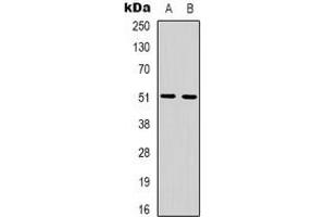 Western blot analysis of Beta-1 Adrenergic Receptor expression in HepG2 (A), A431 (B) whole cell lysates.