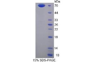 Image no. 1 for Annexin A9 (ANXA9) (AA 1-345) protein (His tag,GST tag) (ABIN4990302) (Annexin A9 Protein (ANXA9) (AA 1-345) (His tag,GST tag))