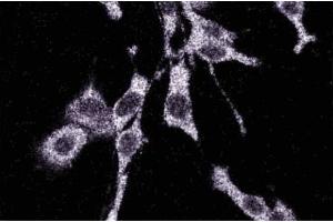 Immunofluorescence staining of RSV-3T3 cells. (MAP3K3 抗体  (AA 27-135))