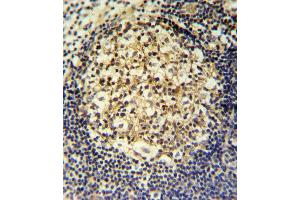 CCR7 Antibody (N-term) (ABIN651190 and ABIN2840119) IHC analysis in formalin fixed and paraffin embedded human tonsil followed by peroxidase conjugation of the secondary antibody and DAB staining. (CCR7 抗体  (N-Term))