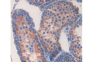 Immunohistochemistry (IHC) image for anti-ATP-Binding Cassette, Sub-Family A (ABC1), Member 6 (ABCA6) (AA 1398-1616) antibody (ABIN5013173)