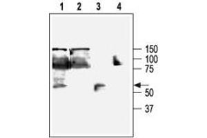 Western blot analysis of KCa3. (KCNN4 抗体  (C-Term, Intracellular))