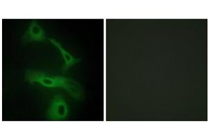 Immunofluorescence analysis of HeLa cells, using CLUS antibody. (Clusterin 抗体  (C-Term))