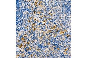 Immunohistochemistry of paraffin embedded rat splenitis using CCL3 (ABIN7073450) at dilution of 1:1000 (400x lens) (CCL3 抗体)