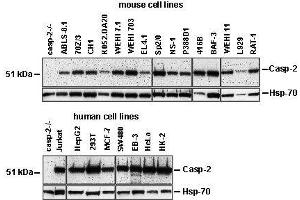 Western Blotting (WB) image for anti-Caspase 2, Apoptosis-Related Cysteine Peptidase (CASP2) antibody (ABIN187544) (Caspase 2 抗体)