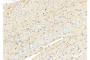 ABIN6266264 and ABIN6277421 at 1/100 staining Rat heart tissue by IHC-P. (PARD6A 抗体  (N-Term))