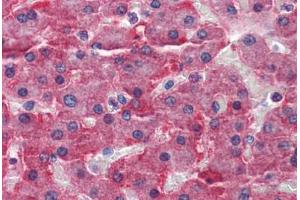 Human Liver: Formalin-Fixed, Paraffin-Embedded (FFPE) (CBS 抗体  (AA 1-101))