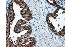 Immunohistochemical staining of paraffin-embedded Kidney tissue using anti-L1CAM mouse monoclonal antibody. (L1CAM 抗体)