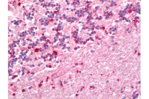 Immunohistochemistry (Paraffin-embedded Sections) (IHC (p)) image for anti-C-Fos Induced Growth Factor (Vascular Endothelial Growth Factor D) (Figf) antibody (HRP) (ABIN2602147)