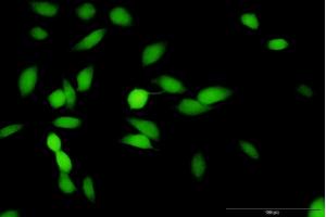 Immunofluorescence of purified MaxPab antibody to HMBS on HeLa cell. (HMBS 抗体  (AA 1-361))