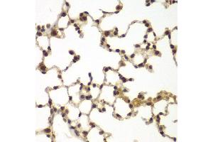 Immunohistochemistry of paraffin-embedded mouse lung using SULT2B1 antibody at dilution of 1:100 (x40 lens). (SULT2B1 抗体)