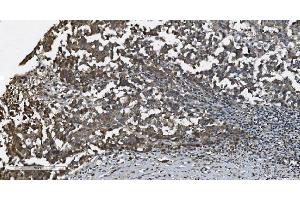 IHC analysis of MAP3K8 using anti-MAP3K8 antibody (ABIN4886663). (MAP3K8 抗体  (AA 9-193))