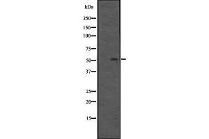 Western Blotting (WB) image for anti-Nucleus Accumbens Associated 1, BEN and BTB (POZ) Domain Containing (NACC1) (Internal Region) antibody (ABIN6259065)