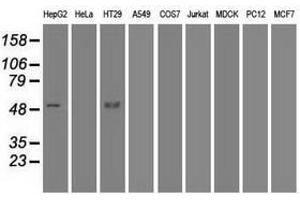 Image no. 6 for anti-serpin Peptidase Inhibitor, Clade A (Alpha-1 Antiproteinase, Antitrypsin), Member 1 (SERPINA1) antibody (ABIN1500874) (SERPINA1 抗体)