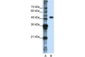 WB Suggested Anti-DDX47 Antibody Titration:  0. (DDX47 抗体  (N-Term))