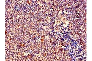 IHC image of ABIN7160506 diluted at 1:400 and staining in paraffin-embedded human tonsil tissue performed on a Leica BondTM system. (MEF2D 抗体  (AA 299-509))
