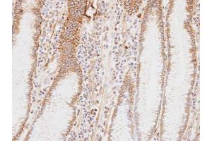 Immunohistochemistry (IHC) image for anti-Hydroxyacyl-Coenzyme A Dehydrogenase/3-Ketoacyl-Coenzyme A Thiolase/enoyl-Coenzyme A Hydratase (Trifunctional Protein), alpha Subunit (HADHA) (C-Term) antibody (ABIN2854961)