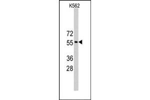 Image no. 1 for anti-Tripartite Motif Containing 69 (TRIM69) (Middle Region) antibody (ABIN357768) (TRIM69 抗体  (Middle Region))