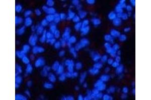 Immunofluorescence analysis of Rat lung tissue using Phospho-CHEK2 (Thr68) Polyclonal Antibody at dilution of 1:200 (CHEK2 抗体  (pThr68))
