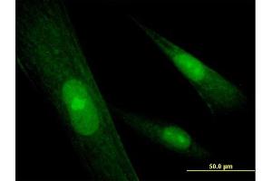Immunofluorescence of purified MaxPab antibody to SRY on Hs 181. (SRY 抗体  (AA 1-204))