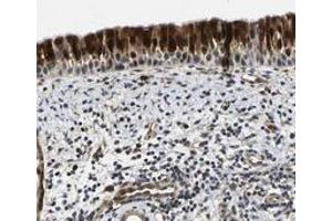 Immunohistochemical staining of human nasopharynx with C12orf35 polyclonal antibody  shows strong nuclear and cytoplasmic positivity in respiratory epithelial cells. (KIAA1551 抗体)